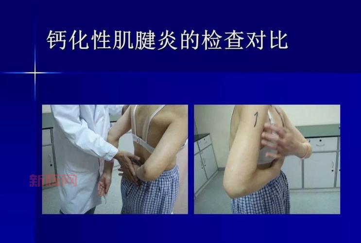 英雄联盟鳄鱼征服者天赋怎么点？看完这篇就懂了！
